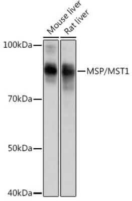 Western Blot: MSP/MST1 Antibody (5R7X2) [NBP3-15250]