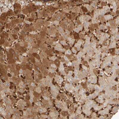 Immunohistochemistry-Paraffin: MSP/MST1 Antibody [NBP1-85330]