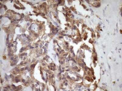 Immunohistochemistry: MSP/MST1 Antibody (OTI1A10) - Azide and BSA Free [NBP2-72792]
