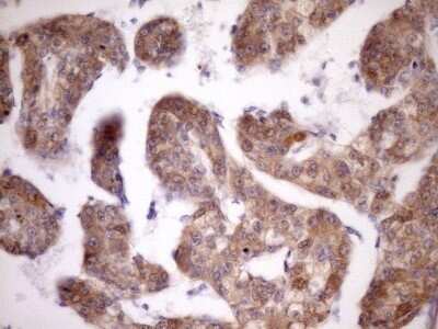 Immunohistochemistry: MSP/MST1 Antibody (OTI1A10) - Azide and BSA Free [NBP2-72792]