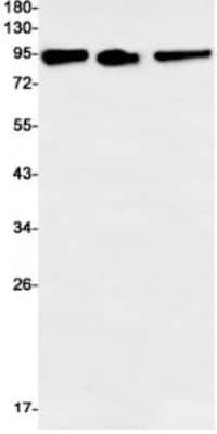 Western Blot: MSP/MST1 Antibody (S04-1D6) [NBP3-19812]