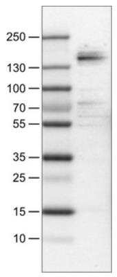 Western Blot: MSPR/Ron Antibody (CL0463) [NBP2-30924]