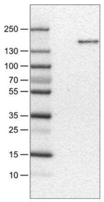 Western Blot: MSPR/Ron Antibody (CL0463) [NBP2-30924]