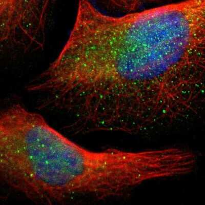 Immunocytochemistry/ Immunofluorescence: MSPR/Ron Antibody [NBP1-88136]