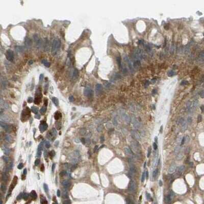 Immunohistochemistry-Paraffin: MSPR/Ron Antibody [NBP1-88137]