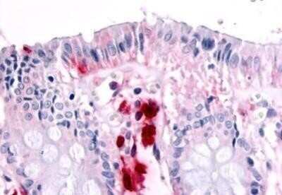 Immunohistochemistry-Paraffin: MSPR/Ron Antibody - BSA Free [NBP1-02377]