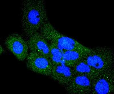 Immunocytochemistry/ Immunofluorescence: MSPR/Ron Antibody (SD2006) [NBP2-67814]