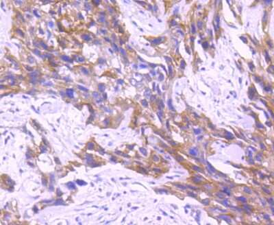 Immunohistochemistry-Paraffin: MSPR/Ron Antibody (SD2006) [NBP2-67814]