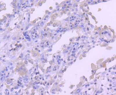 Immunohistochemistry-Paraffin: MSPR/Ron Antibody (SD2006) [NBP2-67814]