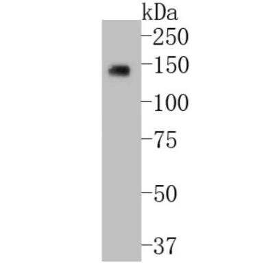 Western Blot: MSPR/Ron Antibody (SD2006) [NBP2-67814]