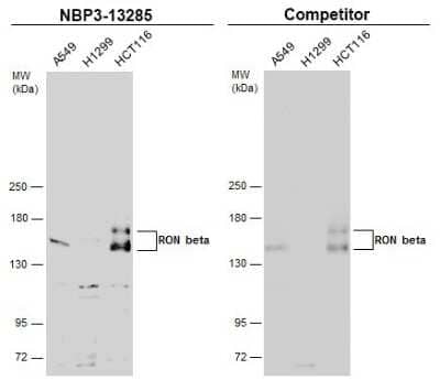 Western Blot: MSPR/Ron Beta Antibody [NBP3-13285]