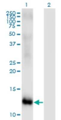 Western Blot: MSRB2 Antibody (2B7) [H00022921-M01]