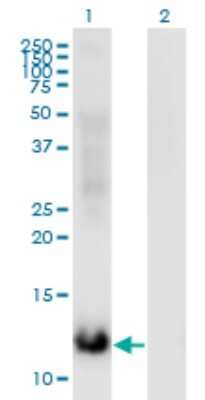 Western Blot: MSRB2 Antibody (3F12) [H00022921-M03]