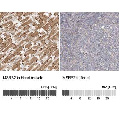 Immunohistochemistry-Paraffin: MSRB2 Antibody [NBP1-86594]