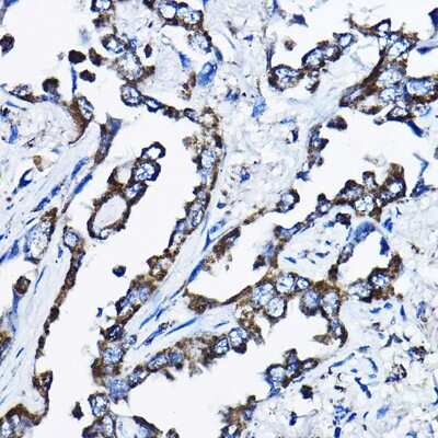 Immunohistochemistry-Paraffin: MSRB2 Antibody - BSA Free [NBP2-94608]