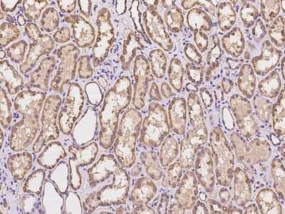 Immunohistochemistry-Paraffin: MSRB2 Antibody [NBP2-97958]