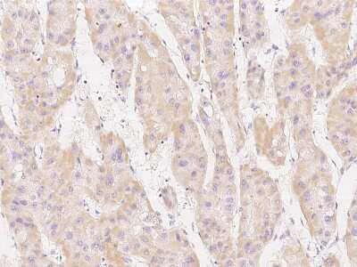 Immunohistochemistry-Paraffin: MSRB2 Antibody [NBP2-99224]