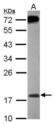 Western Blot: MSRB2 Antibody [NBP2-19420]