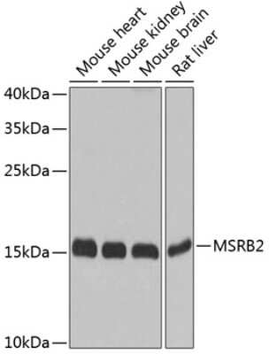 Western Blot: MSRB2 AntibodyBSA Free [NBP2-94608]