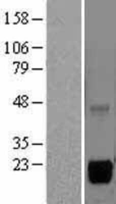 Western Blot: MSRB2 Overexpression Lysate [NBL1-13337]