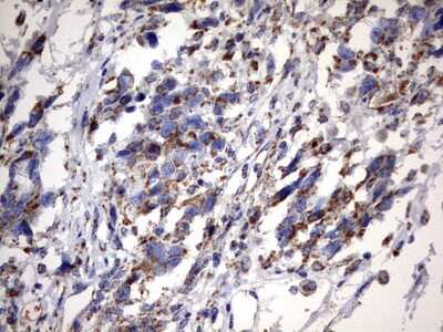 Immunohistochemistry: MSRB3 Antibody (OTI2A2) [NBP2-46023]