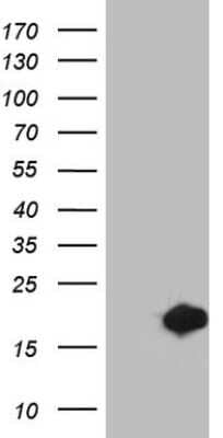 Western Blot: MSRB3 Antibody (OTI2A2) [NBP2-46023]