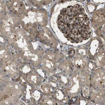 Immunohistochemistry-Paraffin: MSRB3 Antibody [NBP1-84259]