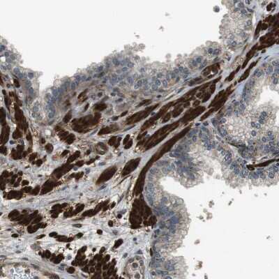 Immunohistochemistry-Paraffin: MSRB3 Antibody [NBP1-84259]