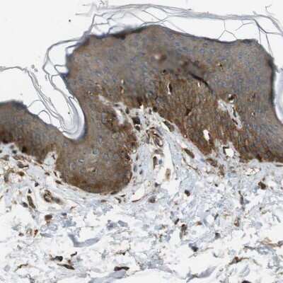 Immunohistochemistry-Paraffin: MSRB3 Antibody [NBP1-84259]