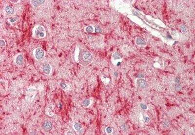 Immunohistochemistry-Paraffin: MSRB3 Antibody [NBP2-85332]