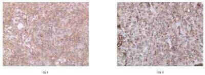 Immunohistochemistry: MSRB3 Antibody (OTI2A2) [NBP2-46023]