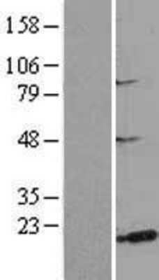 Western Blot: MSRB3 Overexpression Lysate [NBL1-13338]