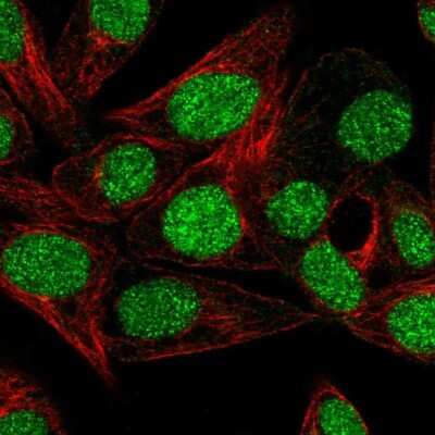 Immunocytochemistry/ Immunofluorescence: MSS4 Antibody [NBP1-87832]