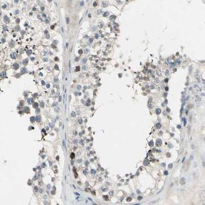 Immunohistochemistry-Paraffin: MSS4 Antibody [NBP1-87832]
