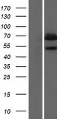 Western Blot: MSS4 Overexpression Lysate [NBP2-10891]