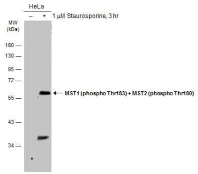 Western Blot: MST1/2 [p Thr180] Antibody [NBP3-13317]