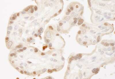 Immunohistochemistry-Paraffin: MST1/2 Antibody [NBP1-28672]