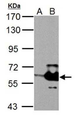 Western Blot: MST2/STK3 Antibody [NBP2-19421]