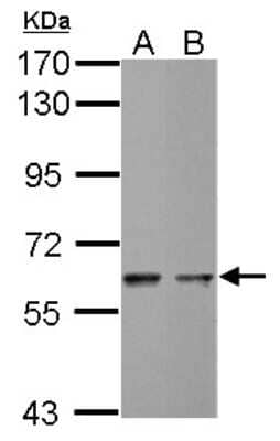 Western Blot: MST2/STK3 Antibody [NBP2-19421]