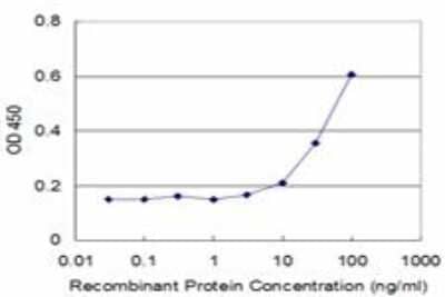 ELISA: MST2/STK3 Antibody (1B3) [H00006788-M11]