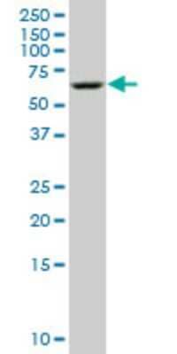 Western Blot: MST2/STK3 Antibody (1B3) [H00006788-M11]