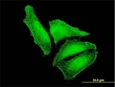 Immunocytochemistry/ Immunofluorescence: MST2/STK3 Antibody (1E9) [H00006788-M03]