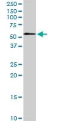 Western Blot: MST2/STK3 Antibody (4F7) [H00006788-M13]