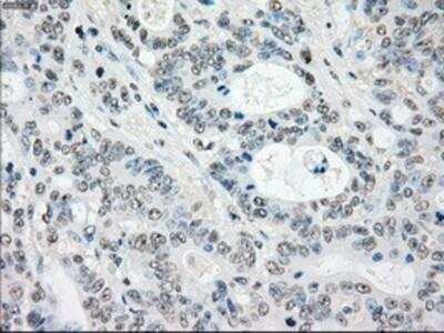 Immunohistochemistry-Paraffin: MST2/STK3 Antibody (OTI4G10) [NBP1-48017]