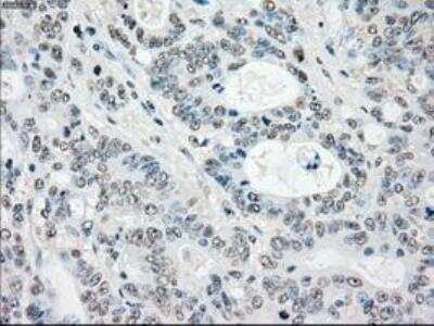 Immunohistochemistry-Paraffin: MST2/STK3 Antibody (OTI4G10) [NBP1-48017]