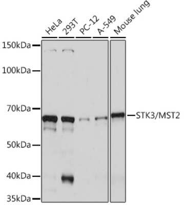 Western Blot: MST2/STK3 Antibody (5J1I4) [NBP3-16737]