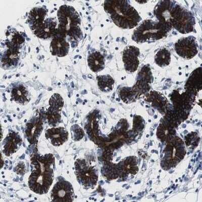 Immunohistochemistry-Paraffin: MST2/STK3 Antibody [NBP1-89586]
