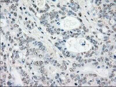 Immunohistochemistry: MST2/STK3 Antibody (OTI4G10) - Azide and BSA Free [NBP2-72794]