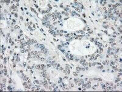 Immunohistochemistry: MST2/STK3 Antibody (OTI4G10) - Azide and BSA Free [NBP2-72794]