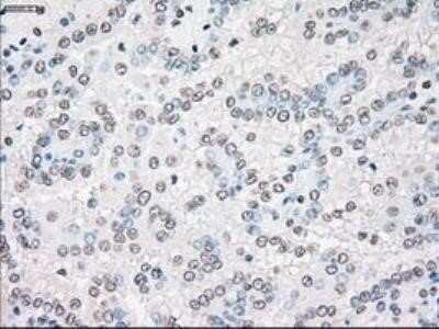 Immunohistochemistry: MST2/STK3 Antibody (OTI4G10) - Azide and BSA Free [NBP2-72794]